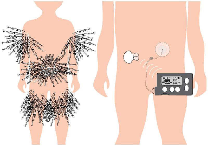 Diabeedis õpilast toetada pole raketiteadus
