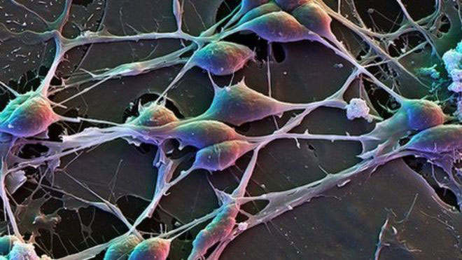 Kas mõte ikka asub peas?