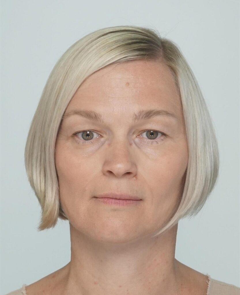 LÕPUTÖÖ ⟩ Täiskasvanutelgi võib esineda kõneprobleeme 